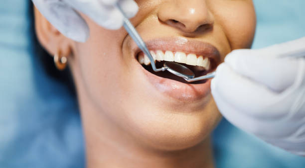 Best Urgent Care for Lost Fillings or Crowns in Mabton, WA